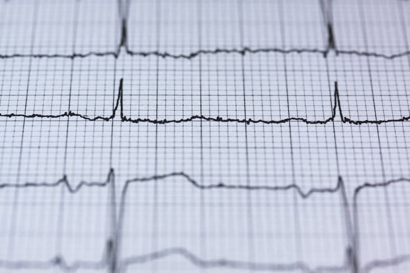 heart chart curve