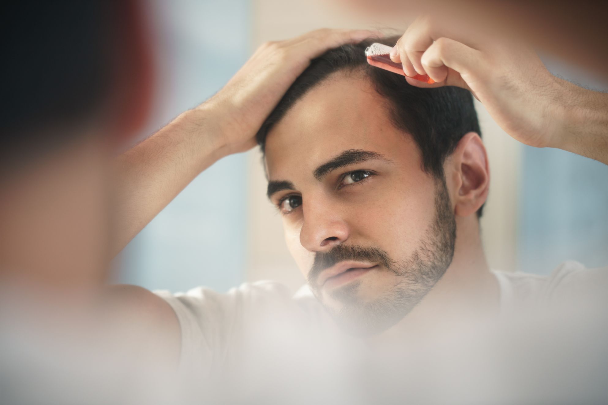 Can I stop my hairline from Receding? Medical and At-Home Treatments