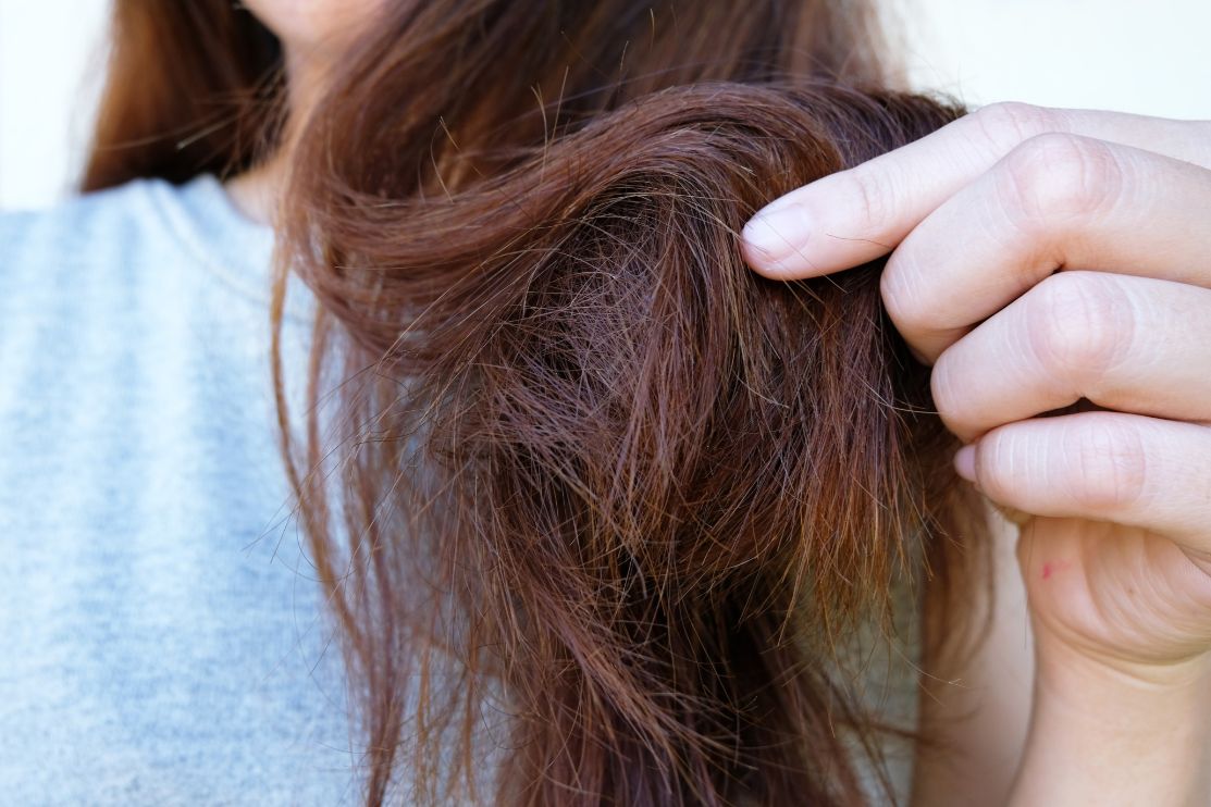 Four Ways to Stop Women's Hair Loss