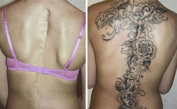 55 Incredible Scar Tattoo Cover Ups Inspirationfeed