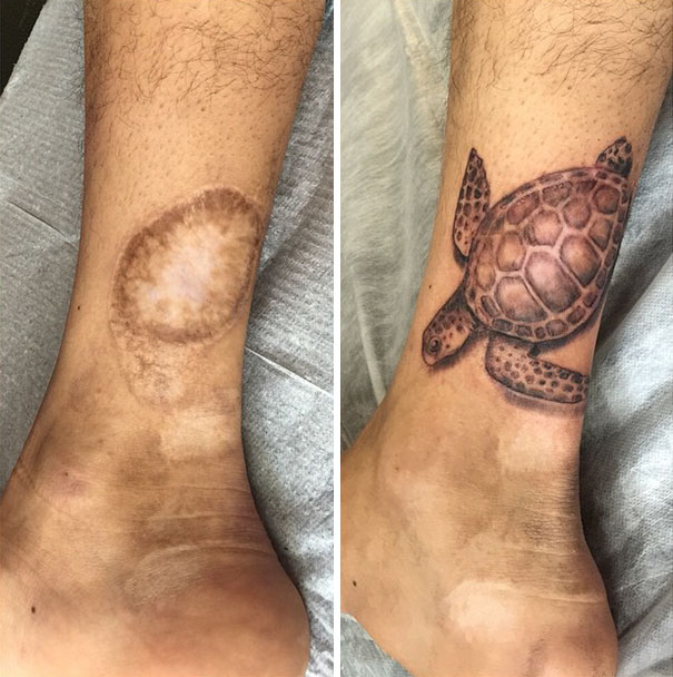 Tattoo Changes After Plastic Surgery for Los Angeles  Dr David Stoker