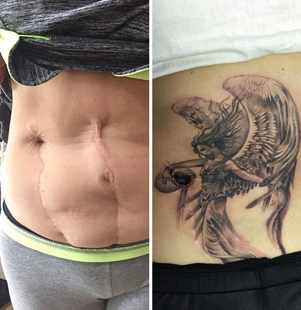 tattoo cover stomach scar