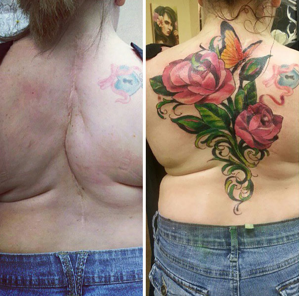 55 Incredible Scar Tattoo Cover Ups Transforming Imperfections Into Art Today