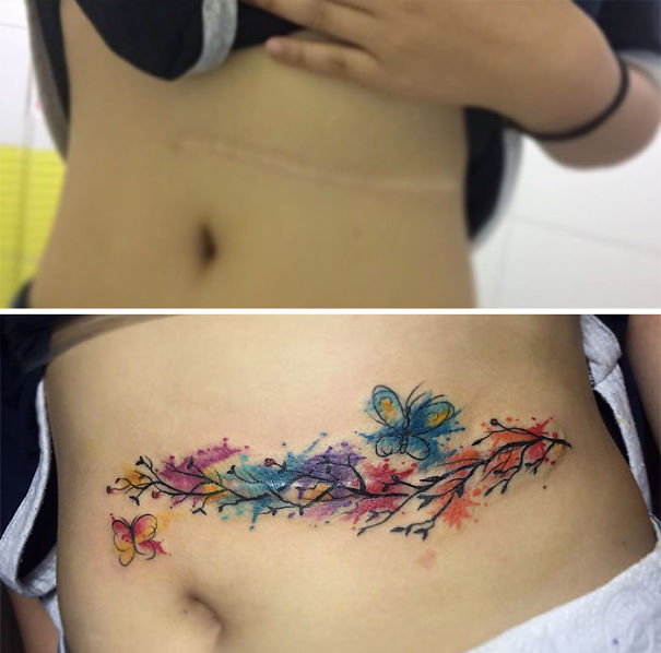 211 Amazing Tattoos That Turn Scars Into Works Of Art  Bored Panda