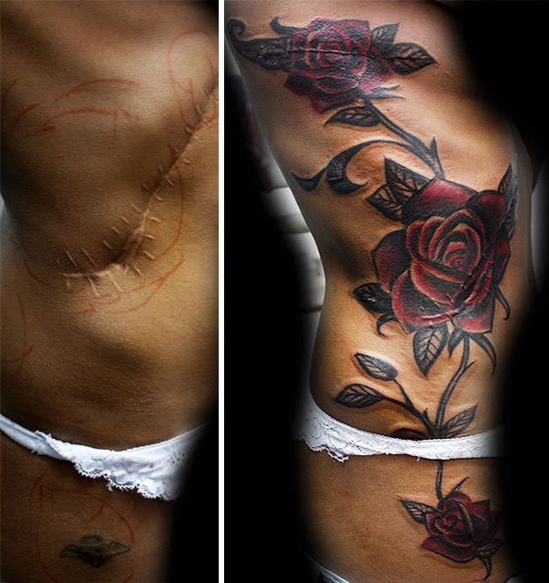 "55 Incredible Scar Tattoo CoverUps Transforming Imperfections into