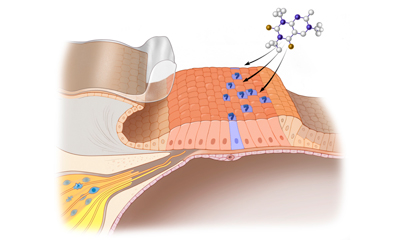 Stem cell therapy for hearing loss